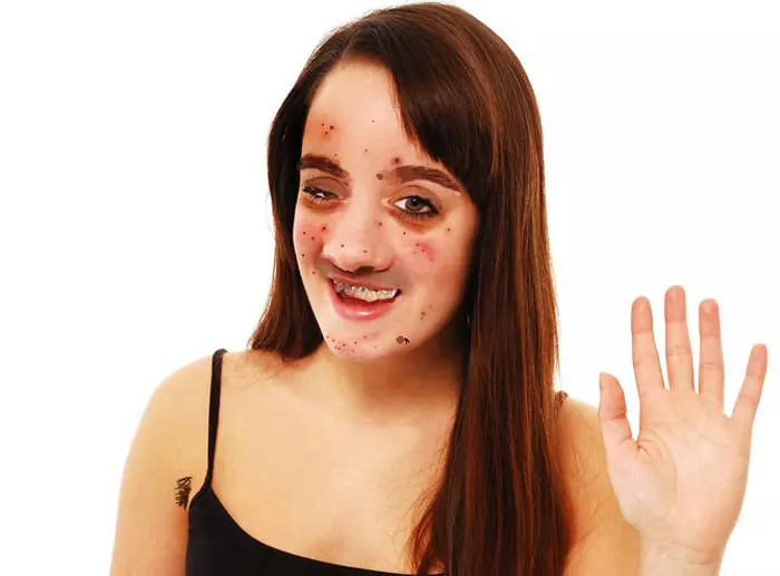 אילוסטרציה