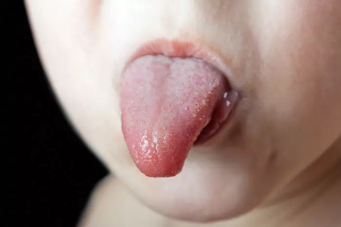 יש דרכים לזהות אם הלשון של התינוק קשורה. כשהוא בוכה, למשל, הלשון נשארת מהודקת אחורנית
