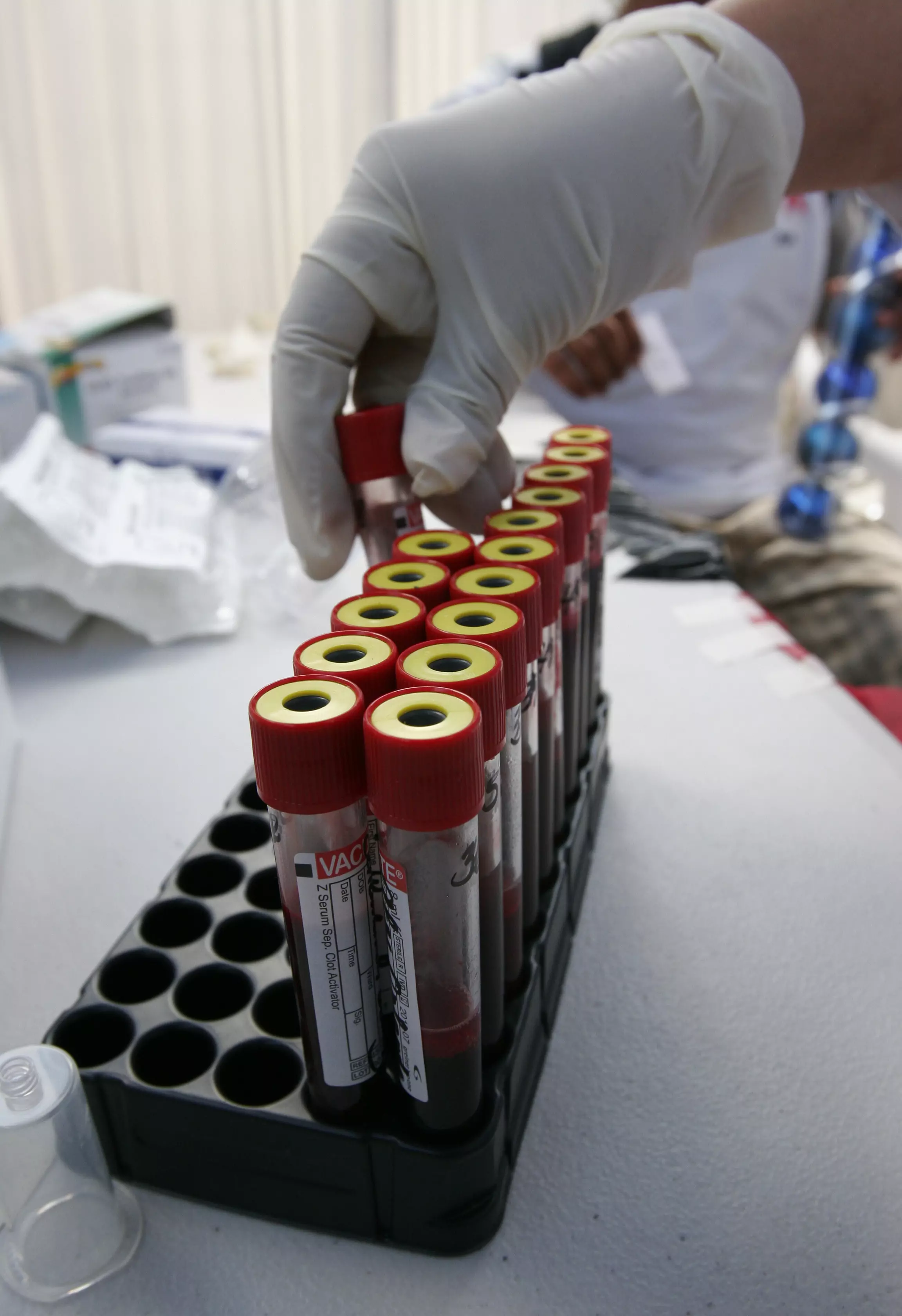 "בעיה מיוחדת בדם". מבחנות נשלחות לבדיקת דם לגילוי ה HIV