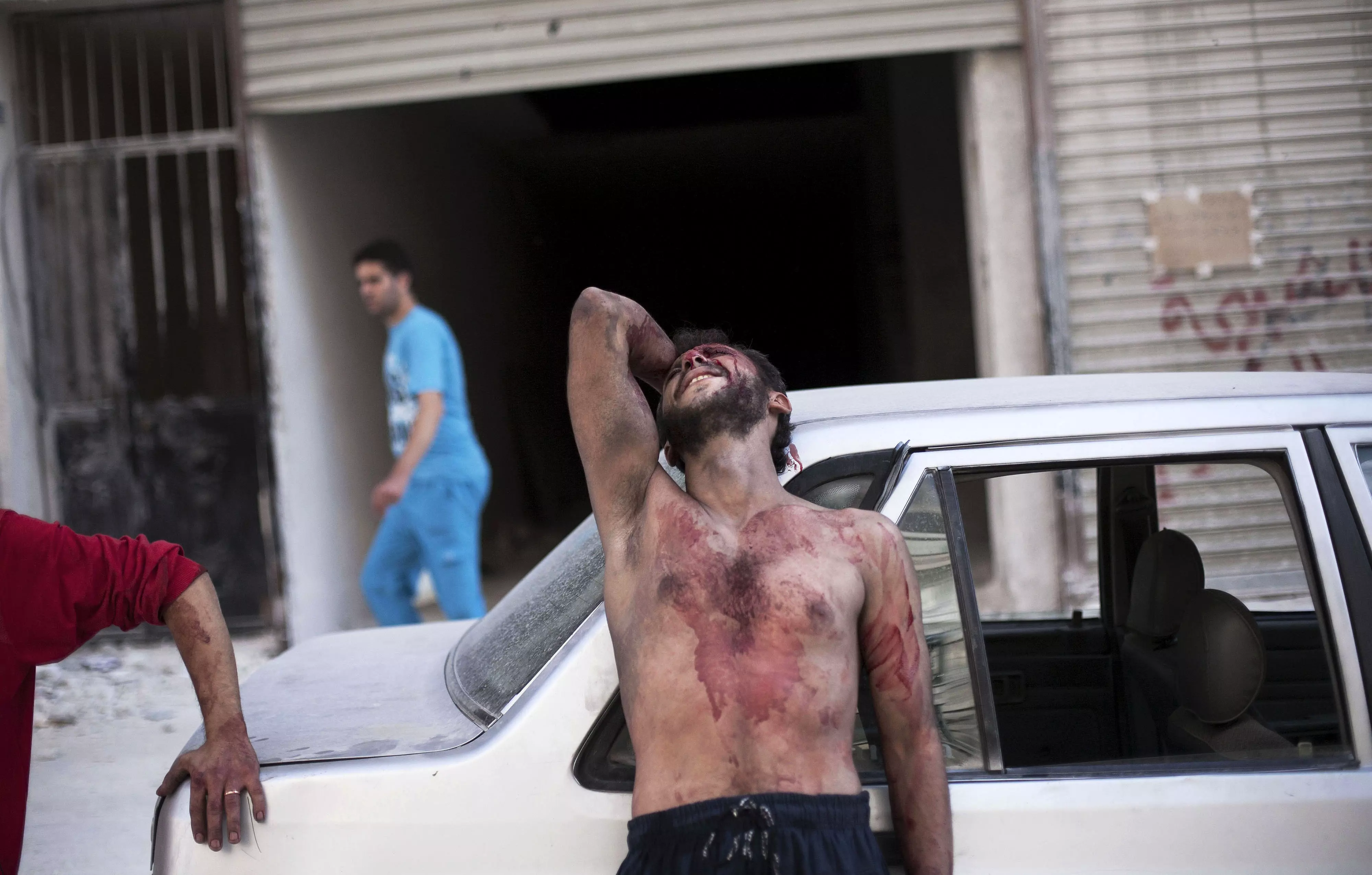תושב חלב שנפגע בהפצצה. חיזבאללה מעורב עמוק מדי במלחמה בסוריה
