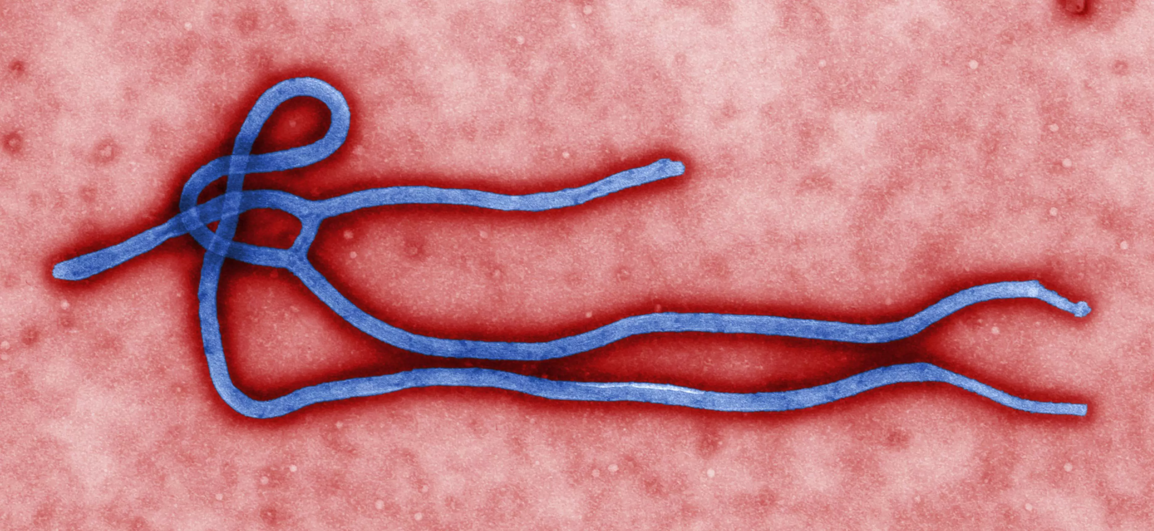 חיידק אבולה דרך עדשת מיקרוסקופ