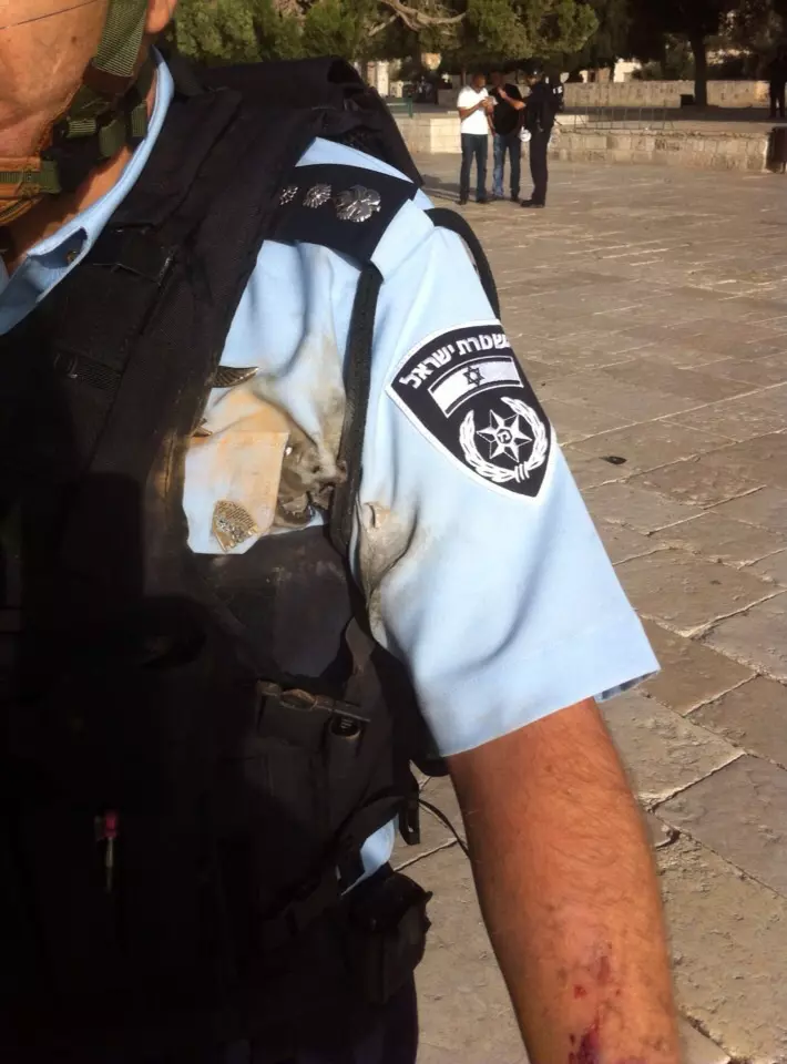 שוטר שנפגע מזיקוק במהומות בהר הבית, בחודש שעבר