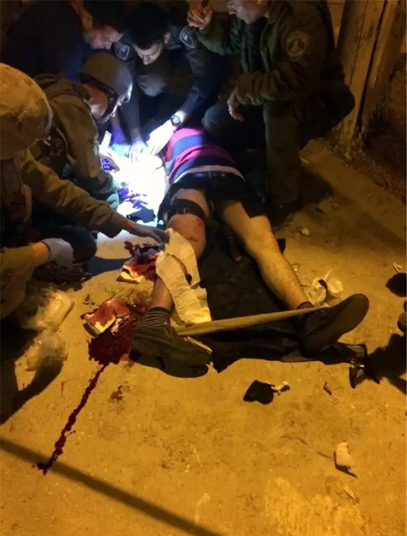 הפלסטיני מטופל על ידי חובשי מג"ב לאחר שנורה בעת שניסה לחטוף נשק משוטר