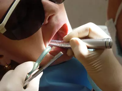 טיפול שיניים רופא