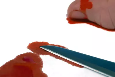 דקירה דם סכין