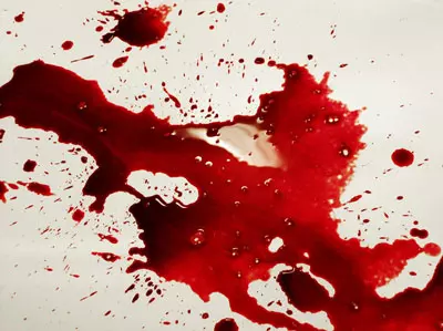דקירה דם סכין אלימות דימום כתמים
