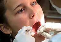 לפני כשלושה שבועות אף הוחלט להרחיב את טיפולי השיניים לילדים