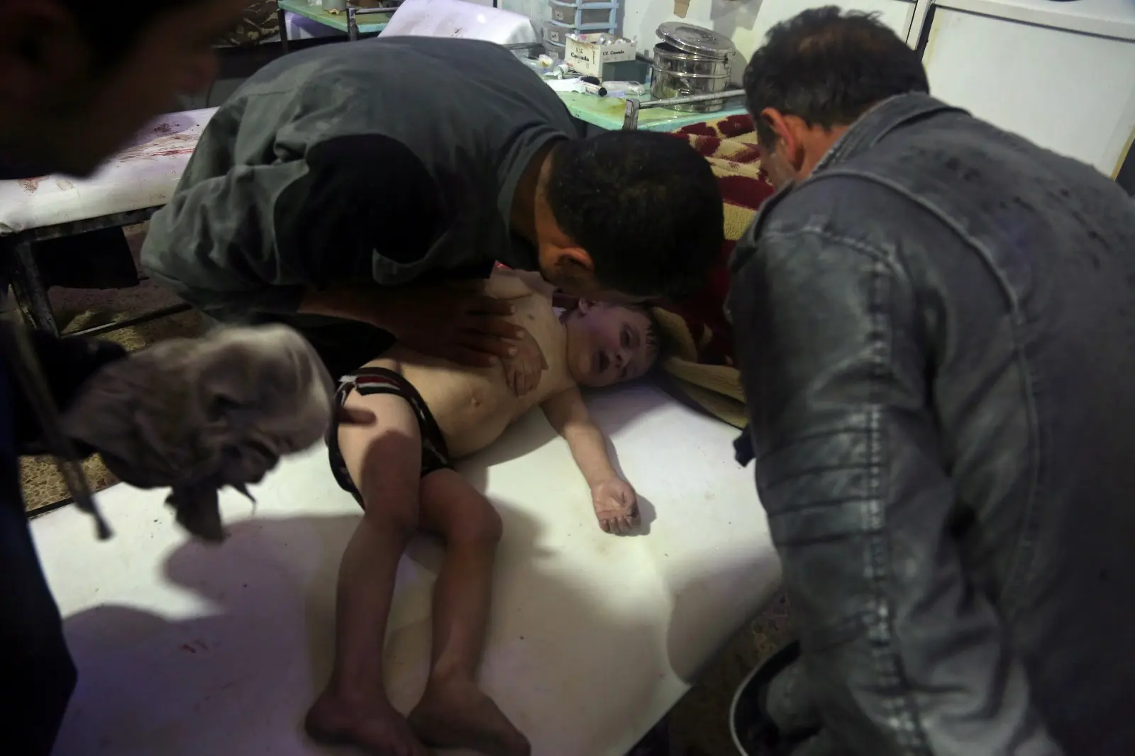 ילד שנפגע במתקפה הכימית בדומא, אפריל
