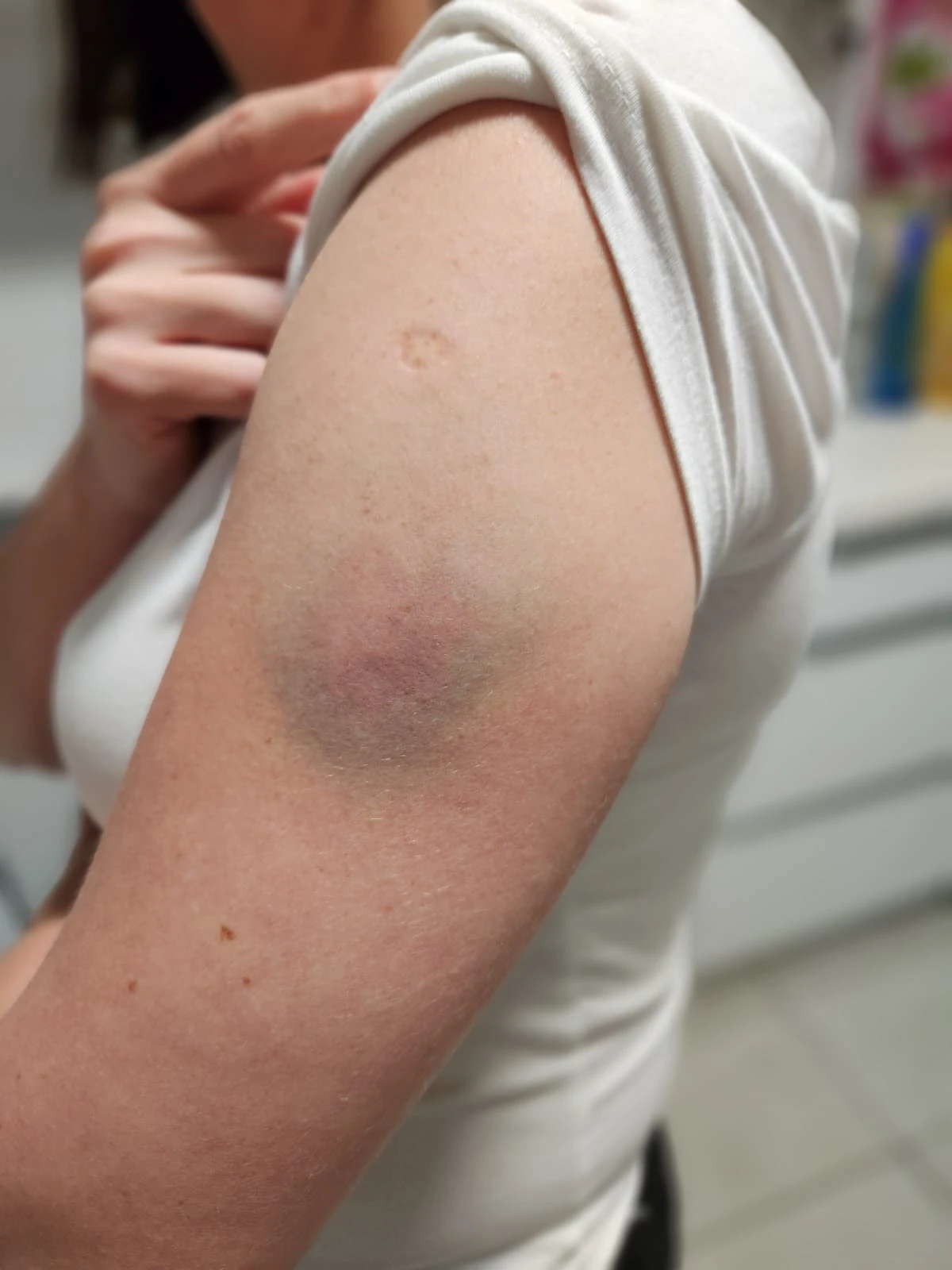 חברת צוות רפואי הותקפה באסותא באר שבע