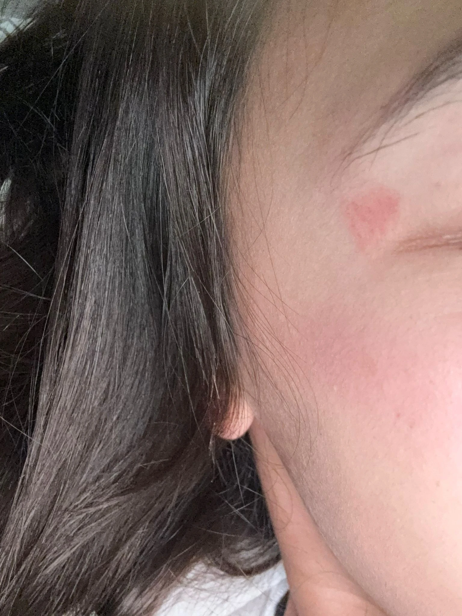 סימני אלימות על פניה של בתה של חנית אלמקייס