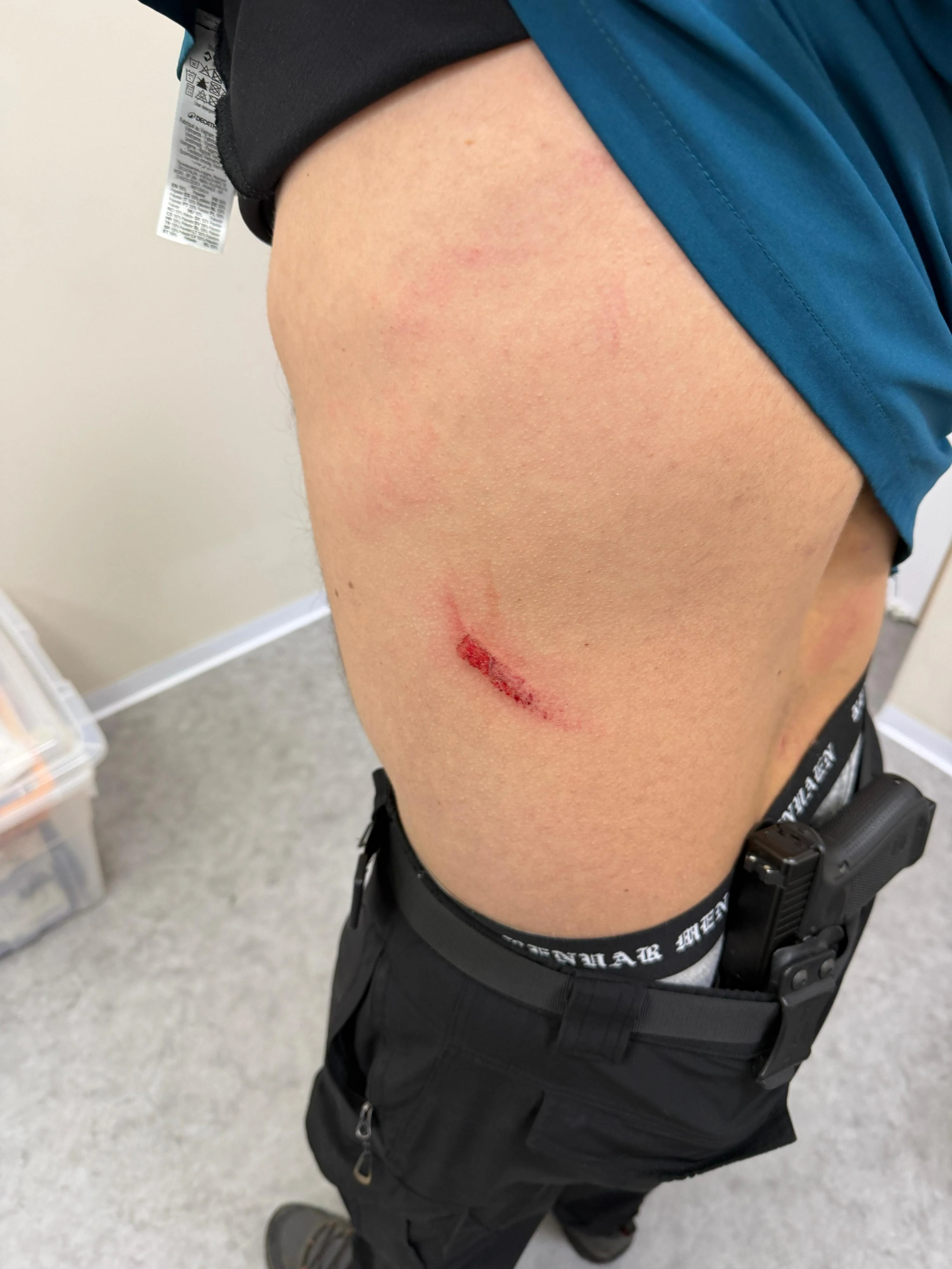 רון אדלשטיין לאחר התקיפה