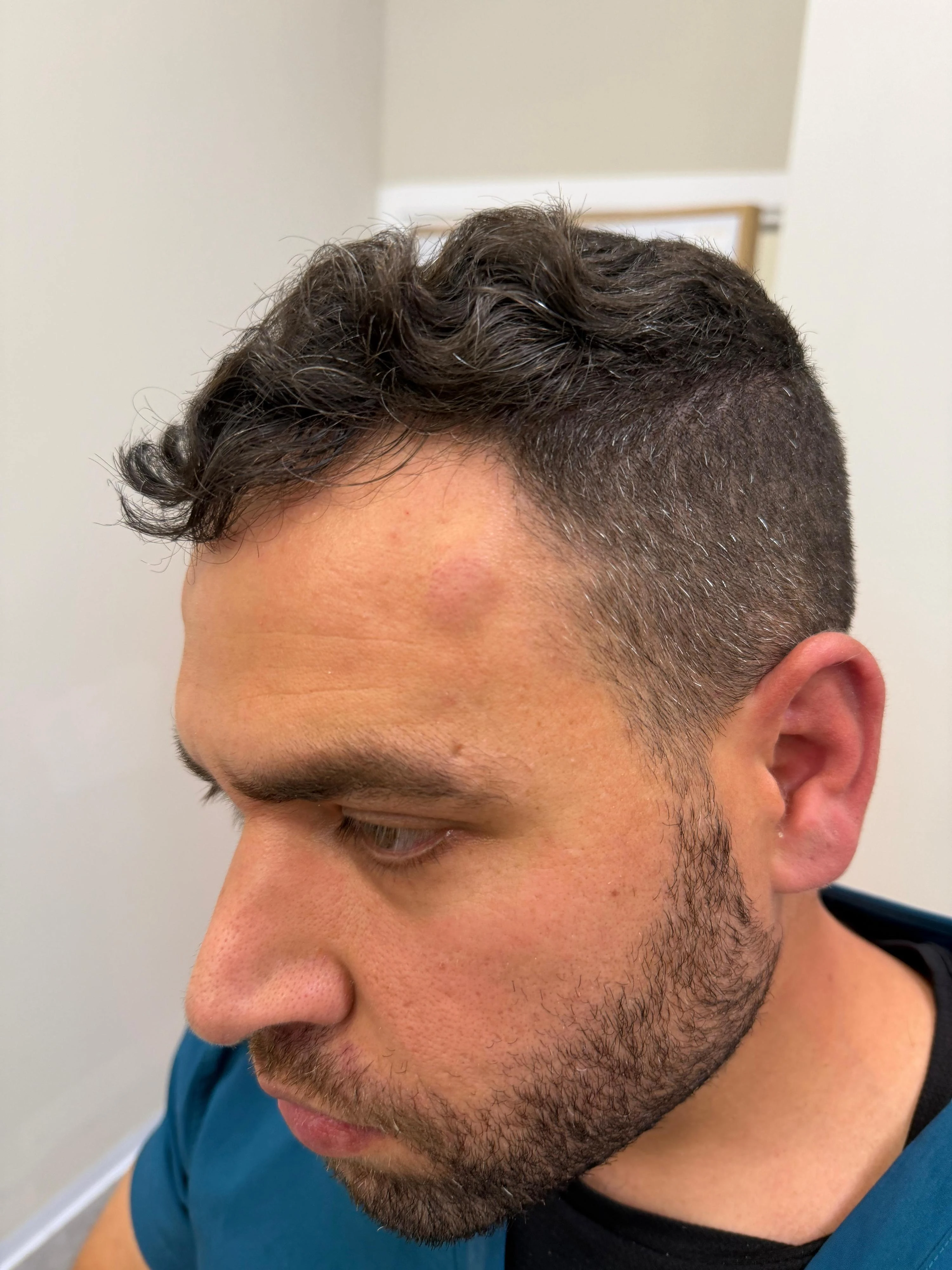 רון אדלשטיין לאחר התקיפה