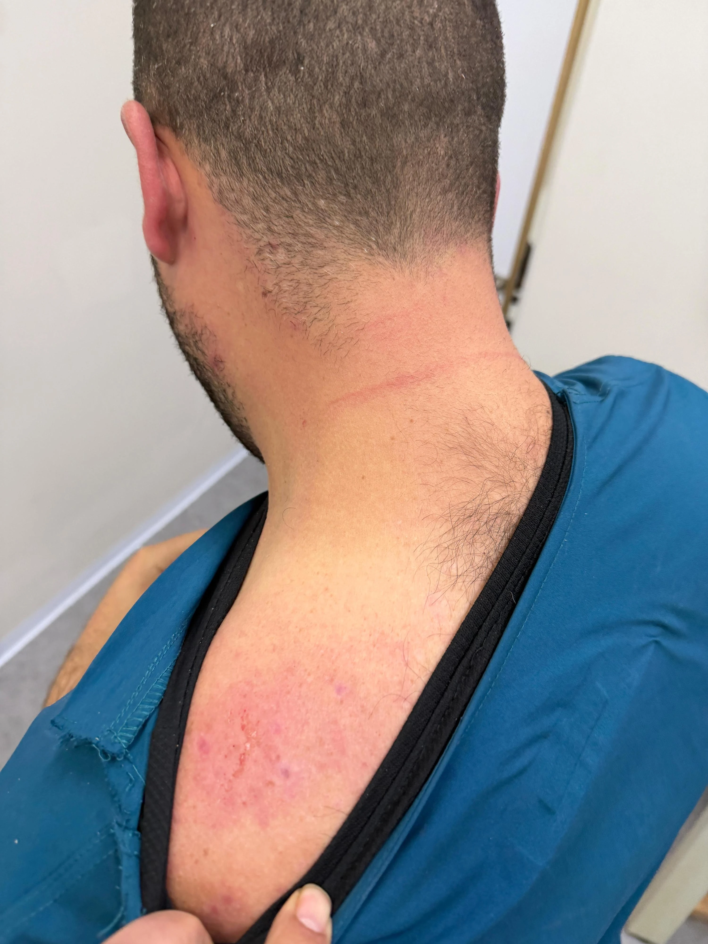 רון אדלשטיין לאחר התקיפה