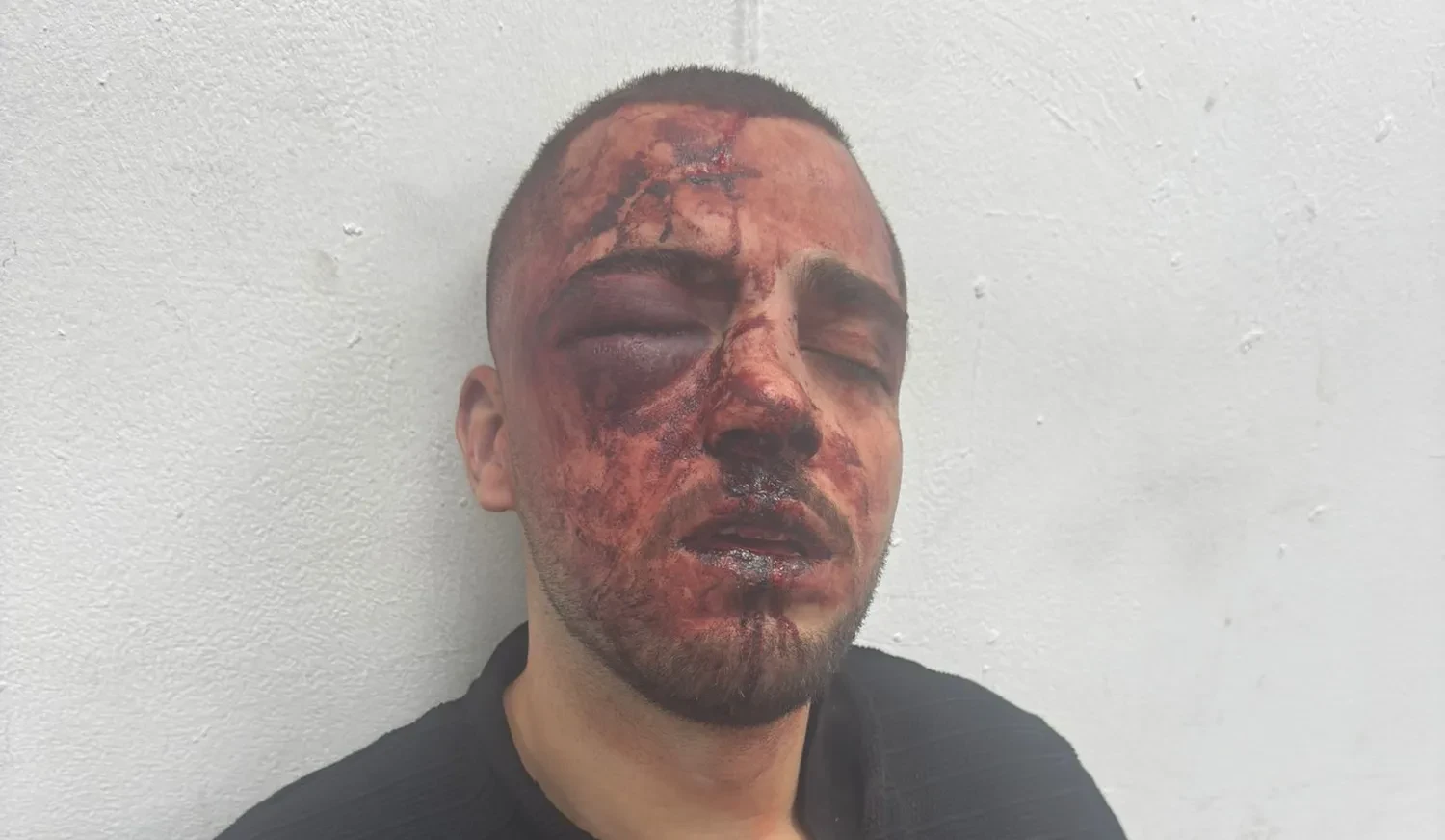 עו"ד סאלח נעמה לאחר מעצרו האלים