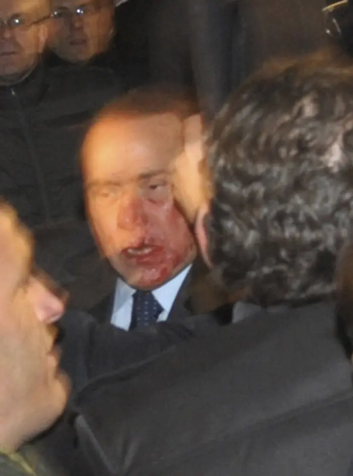 ראש ממשלת איטליה סילביו ברלוסקוני מדמם מפניו לאחר שהותקף במילאנו