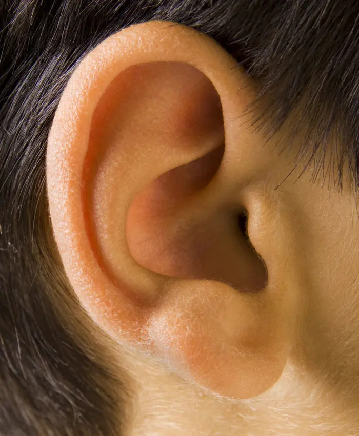 השתל מותקן בתוך הגולגולת על האפרכסת ולו מחברים מכשיר שמיעה ייחודי, העוקף את המערכת הפגומה באוזן