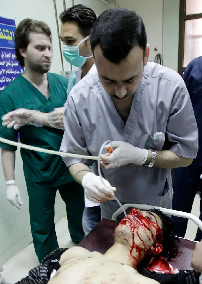 פצוע שנפגע מקליע בראשו מטופל בבית החולים בעיר