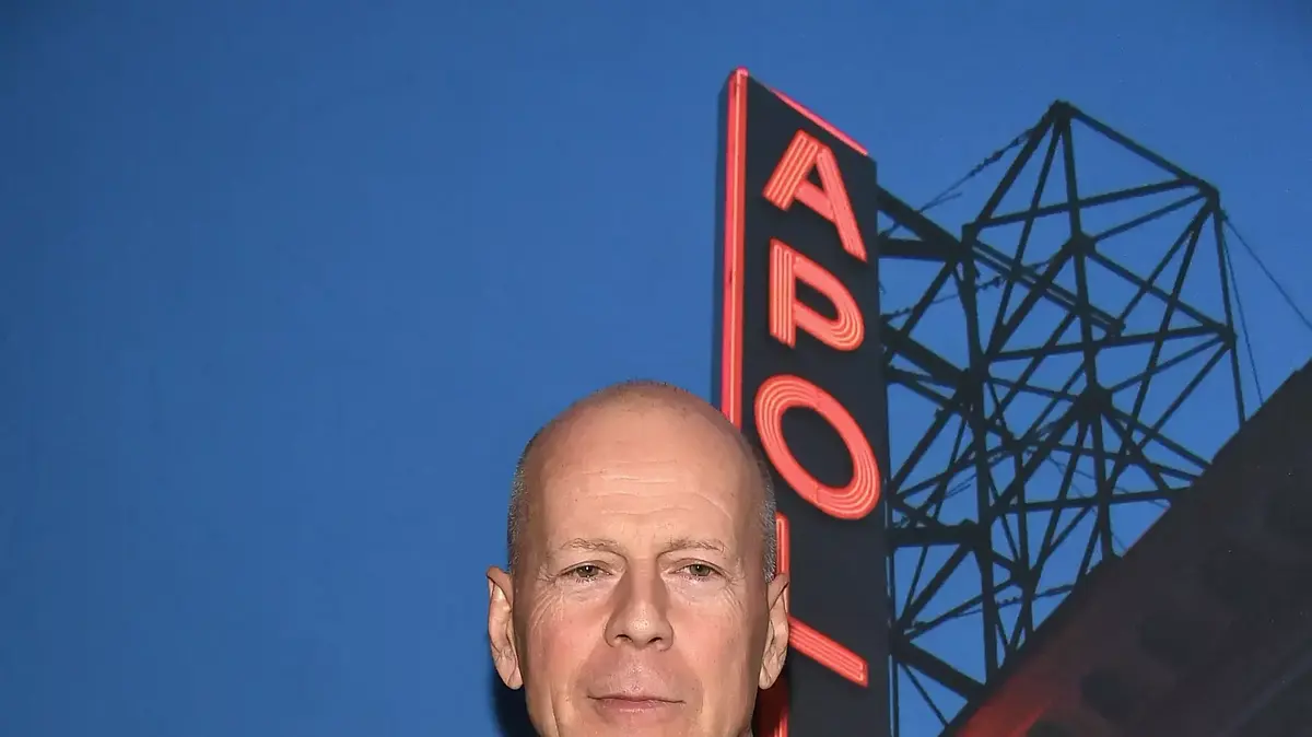 Aphasia This is the disease that caused Bruce Willis to end his career