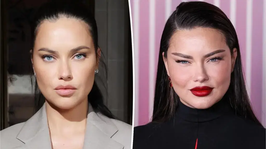 "What did Adriana Lima do to her face?!" is her response voila! fashion