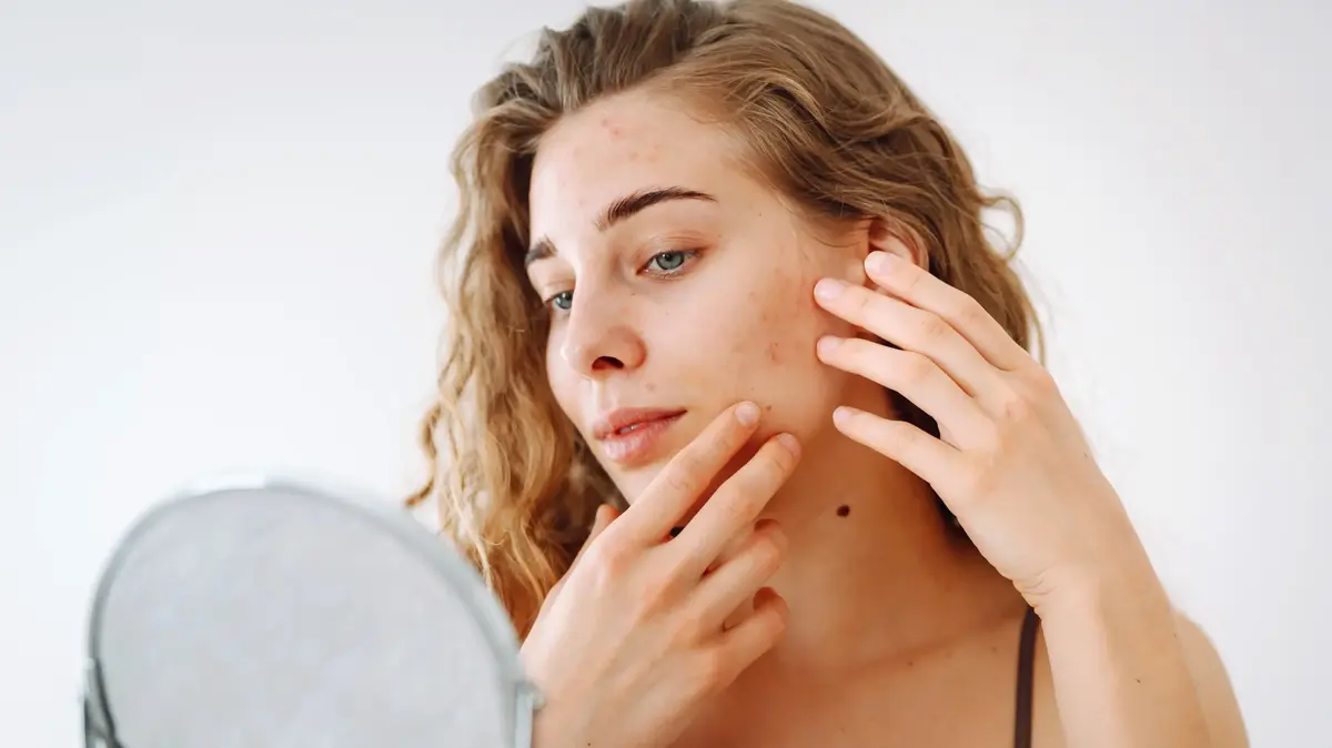 חושבים שזה סתם פצעון? הסימנים על הפנים שדורשים ביקור דחוף אצל רופא