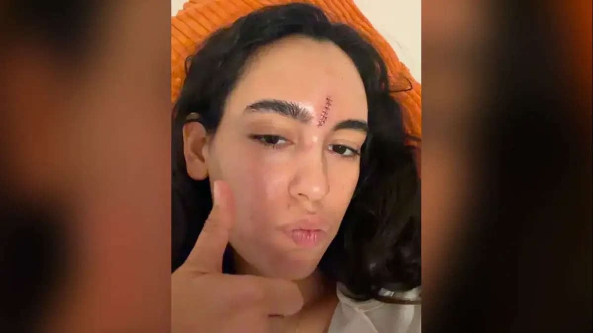 נועם קליינשטיין התעלפה ונחבלה בראשה: "התוכניות השתנו"