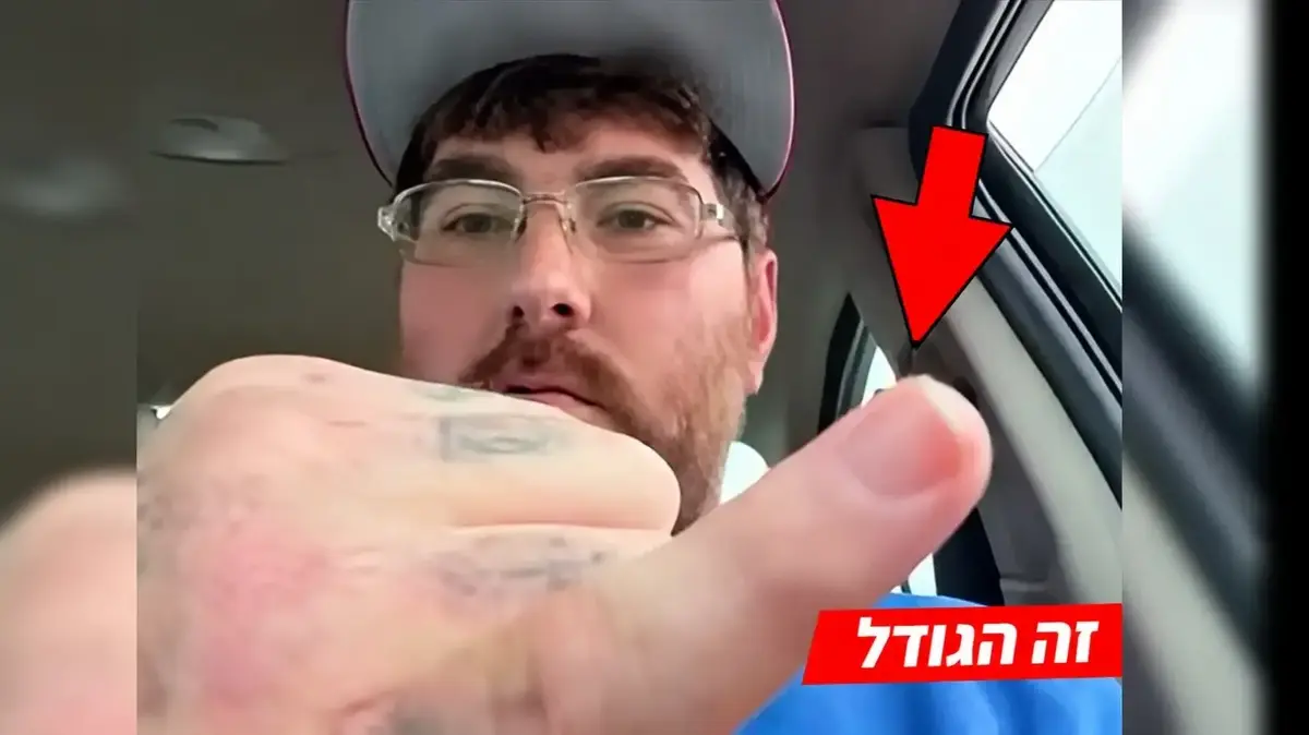 האיש עם "הפין הכי קטן בעולם" עבר הליך הגדלה – וזה מה שקרה