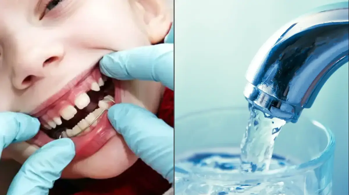 New Study: Increase in Dental Treatments for Children Following the Cessation of Water Fluoridation | Integri News