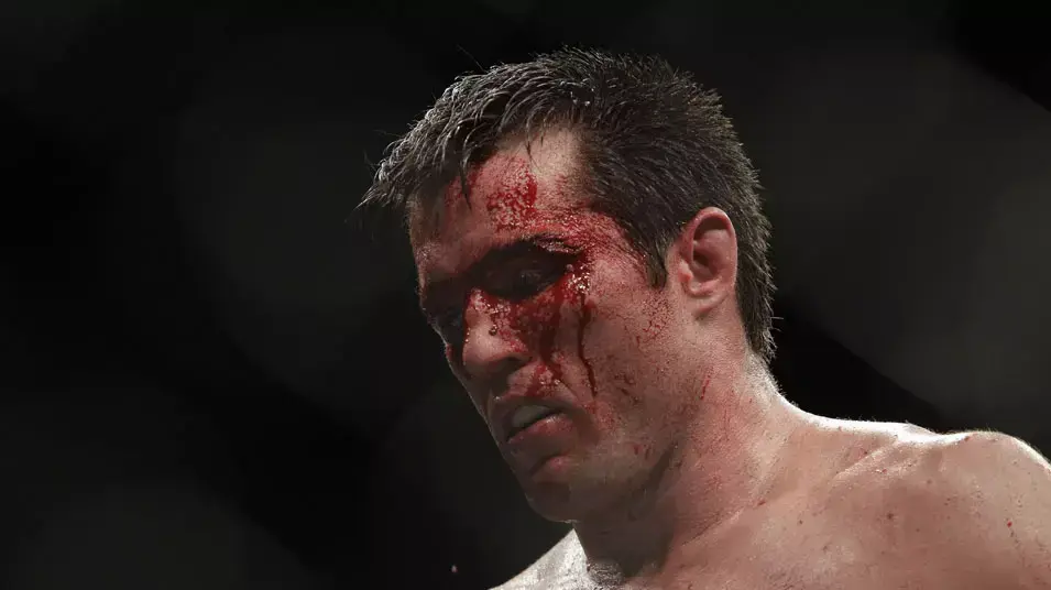 צ'ייל סונן לוחם MMA