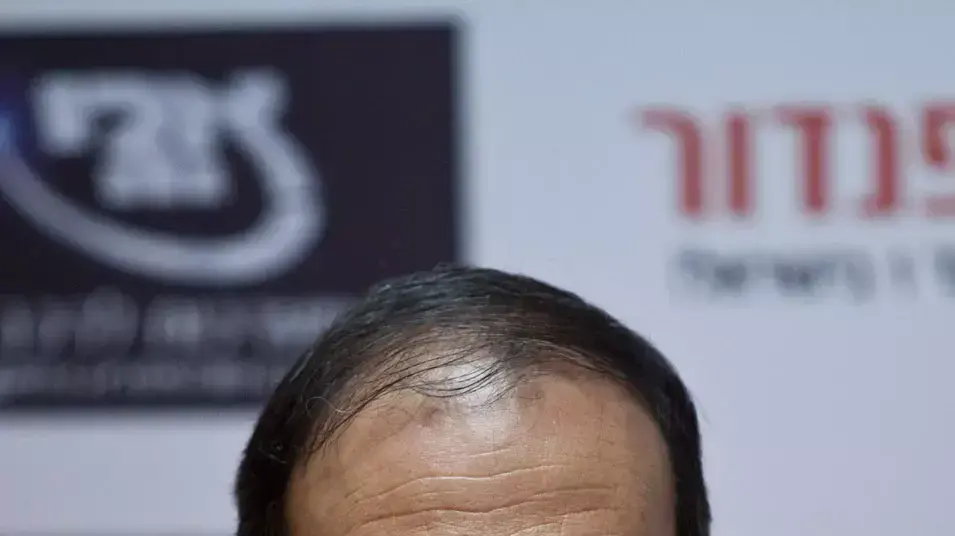 דב צור, ראש עיריית ראשון לציון