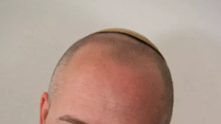 בעקבות הדו"ח: גנץ הדיח את ארז וינר מצה"ל