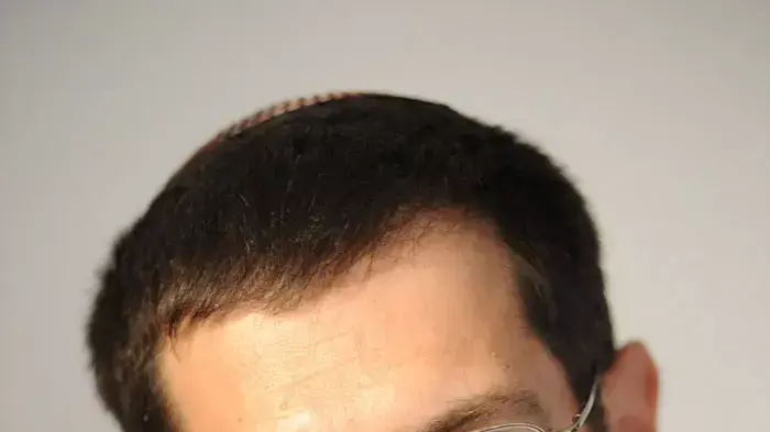 אורי אורבך