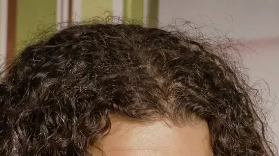 אחיה אדלשטיין