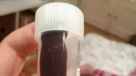 מטיילת מצאה עלוקה באף