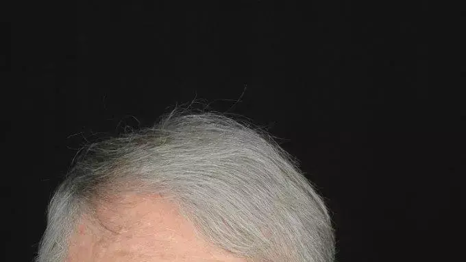 קלוד לנצמן