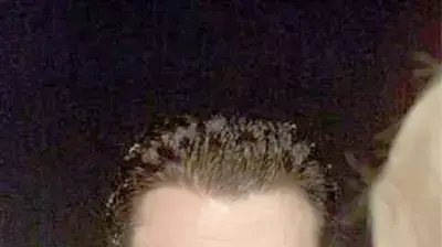 רפי עגיב