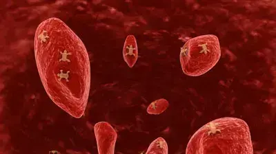 cancer cells  תאי סרטן