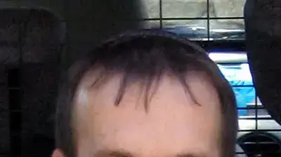 רסן רועי קליין
