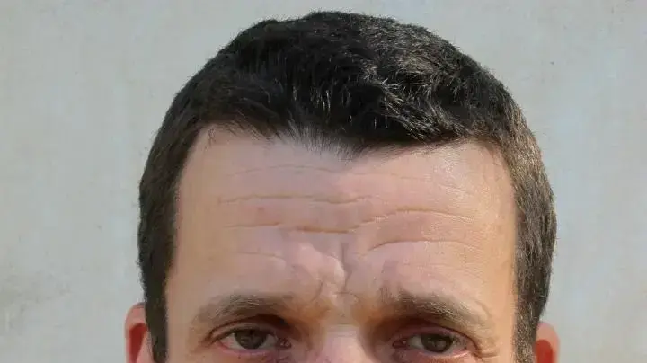 משה פרסטר