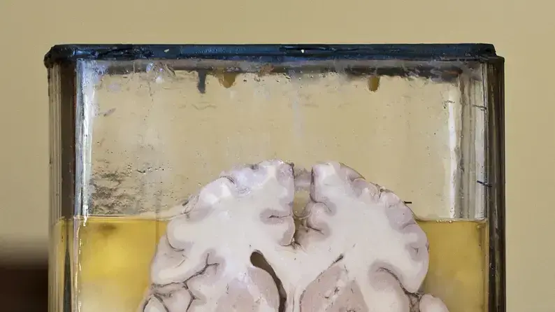 פיסת מוח משומרת בתוך צנצנת פורמלין