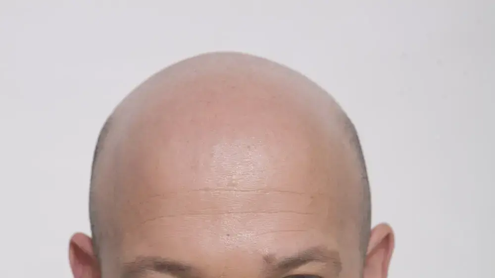 דרור משעני