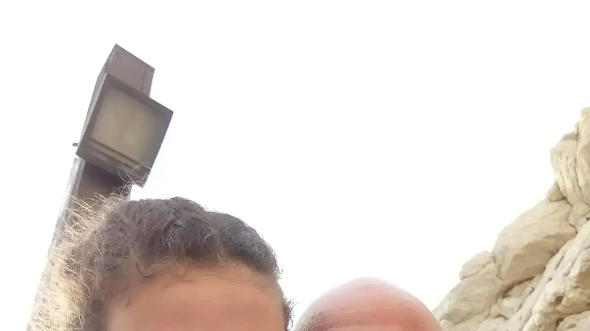 אור וניר בר טל - תסמונת רט