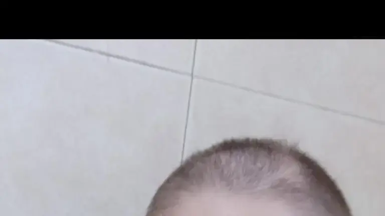אלינור אחרי שגילחה את שיערה