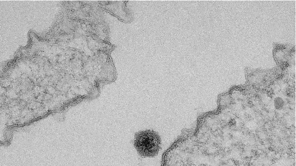 וירוס Yaravirus וירוס Yaravirus