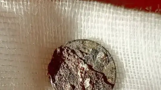 מטבע שנתקע באפו של אדם ברוסיה