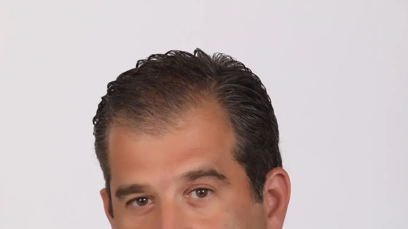 אסי שמלצר
