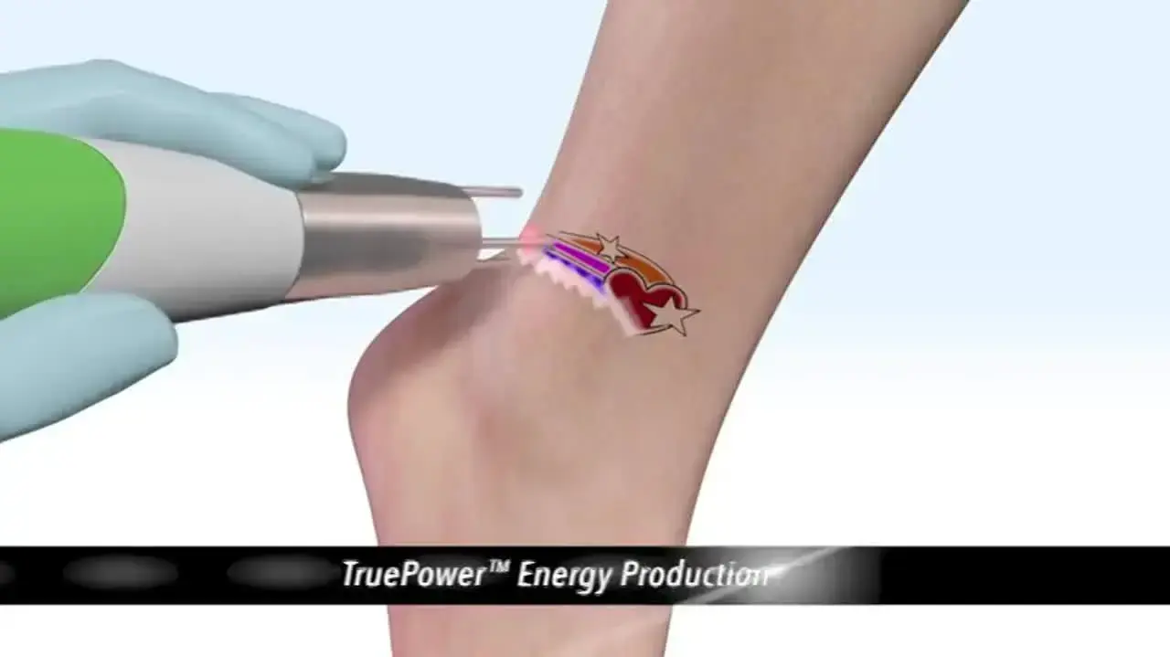 PURE LASER