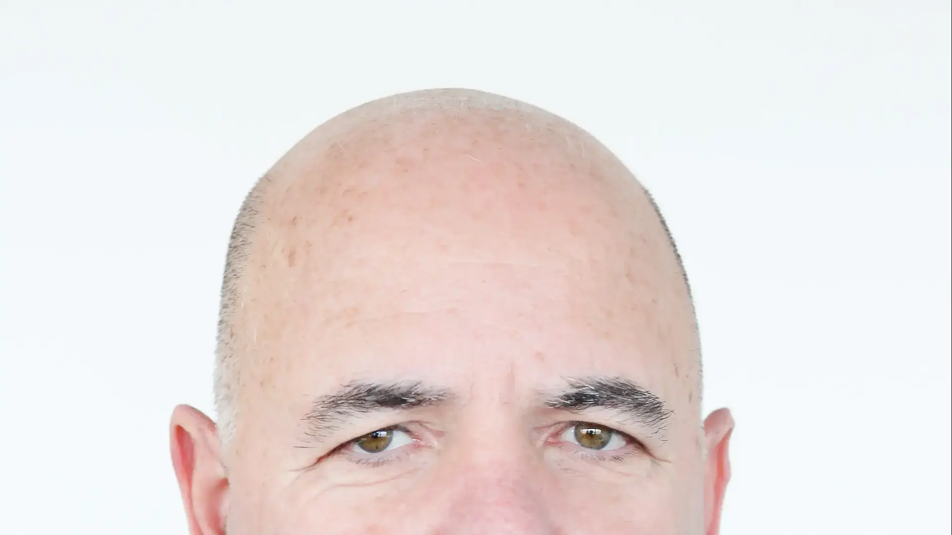 אילן פלטו