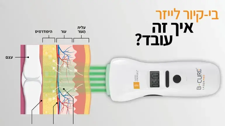 בי קיור לייזר - איך זה עובד?