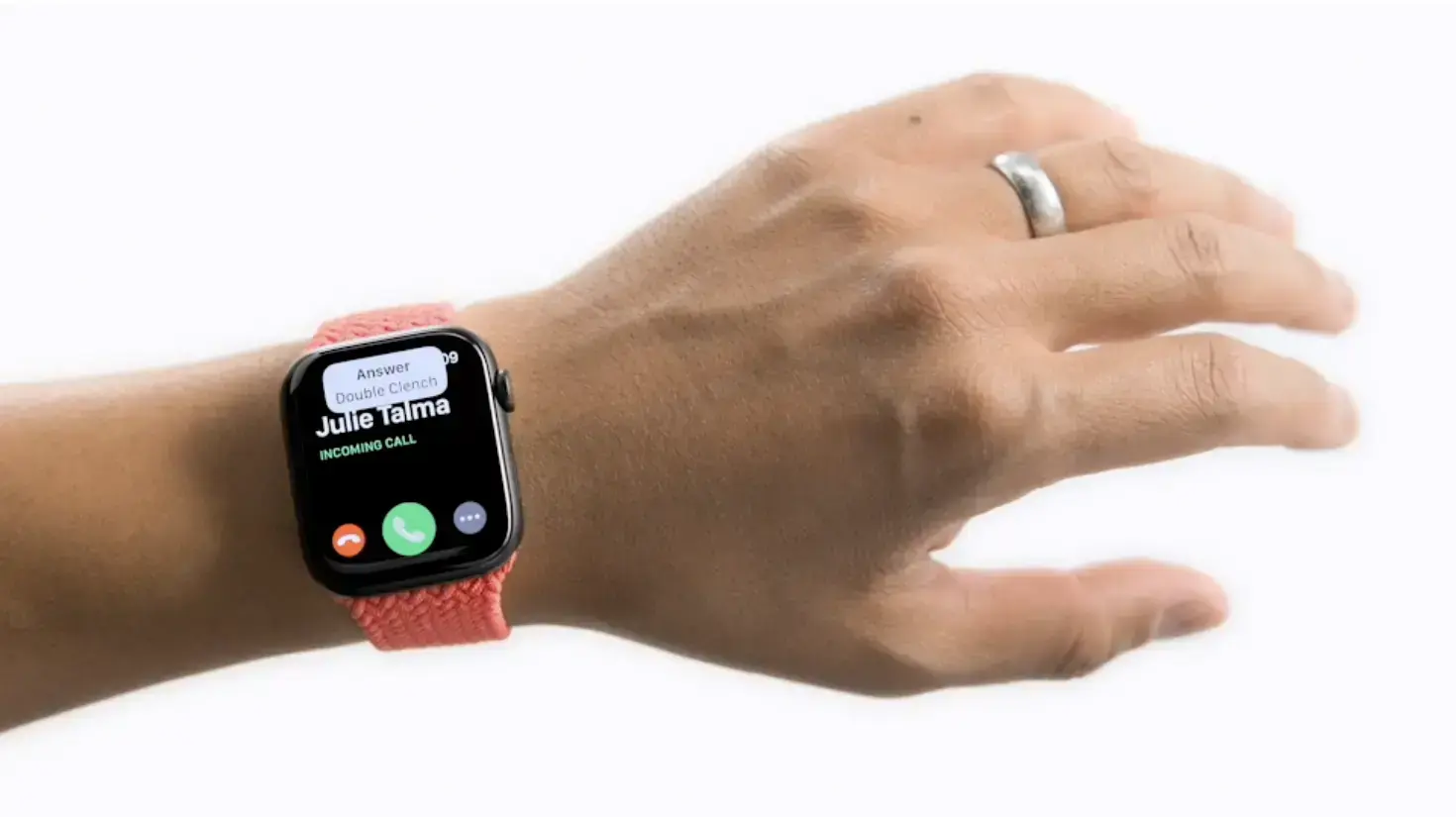 אפל watch
