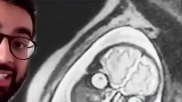 איך נראים תינוקות ב-MRI